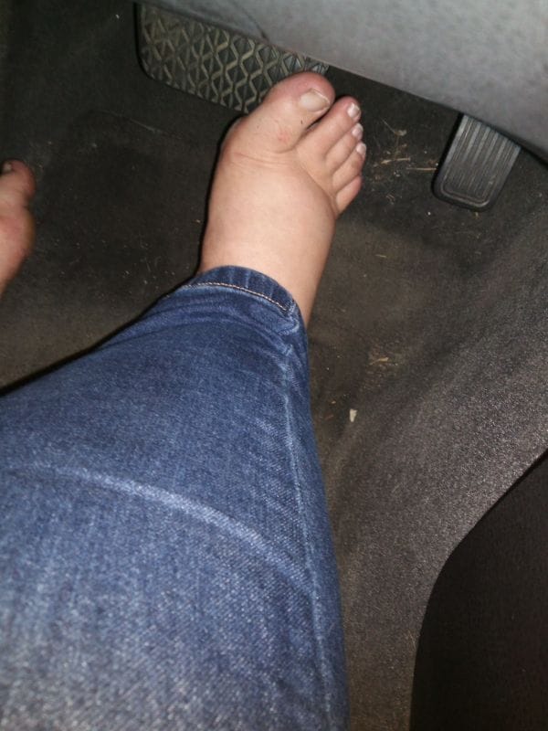 Bare foot on a car pedal